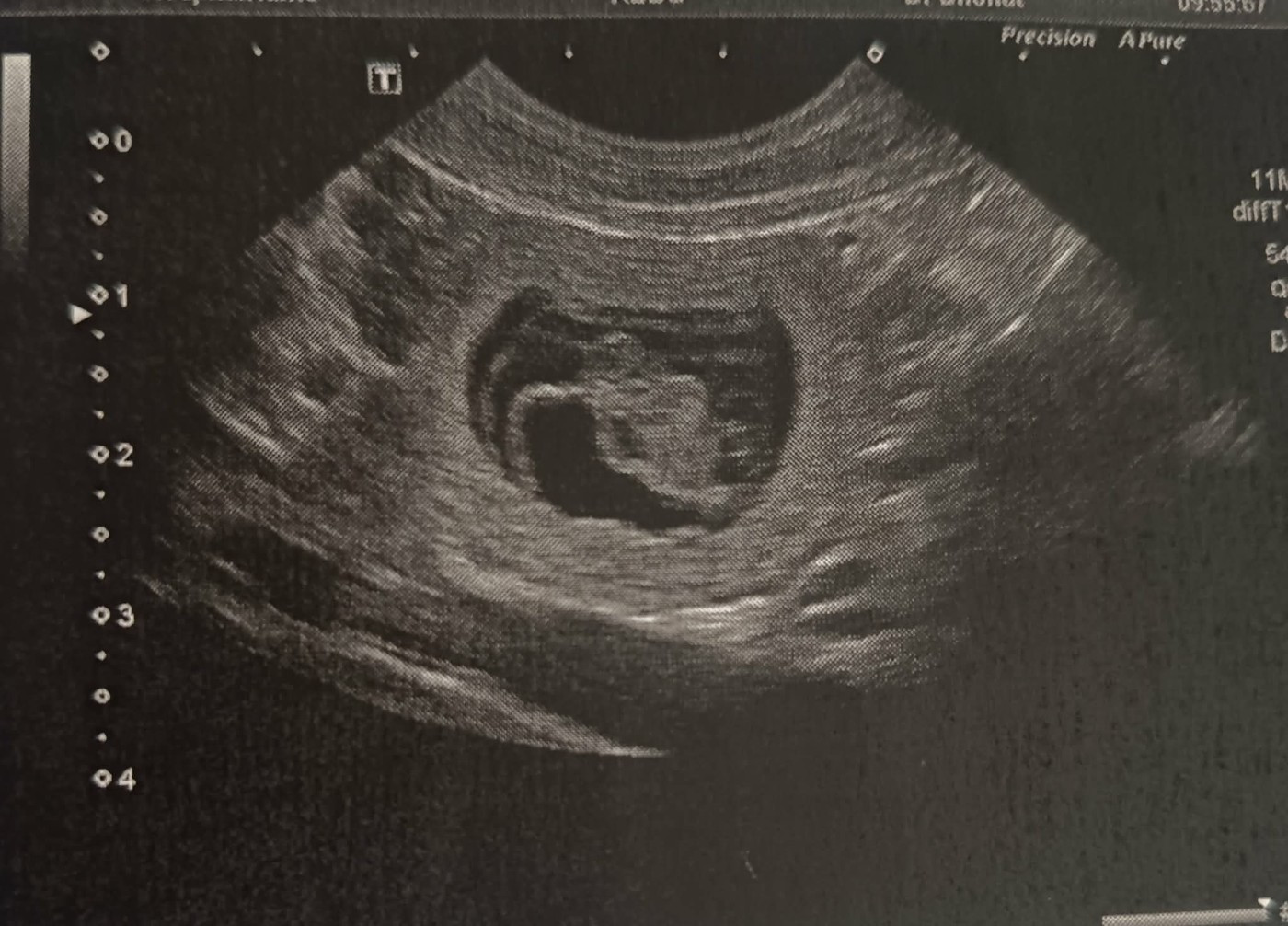 Confirmations de gestations !